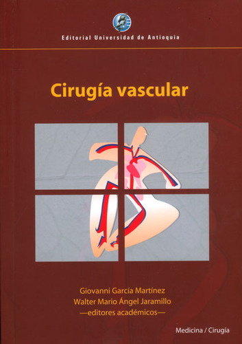 Cirugía Vascular