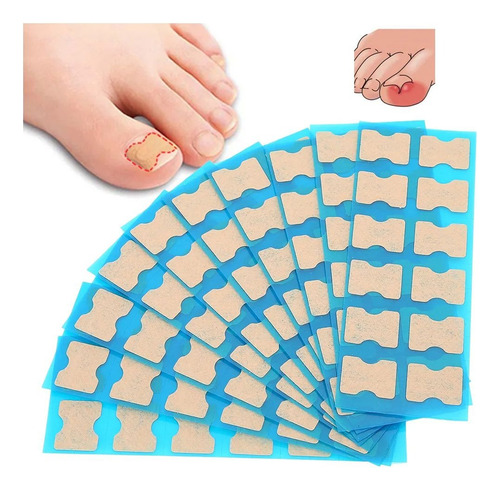 Corrector De Uñas Encarnadas De Pegatinas Viscosidad 120pz