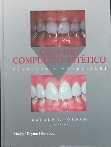 Libro Grabado Compuesto Estetico : Tecnicas Y Materiales De