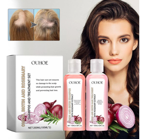 Shampoo De Biotina, Cebola E Alecrim Para O Crescimento Do C