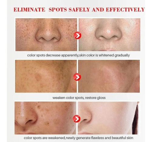 Creme Milagroso Pomada Tira Manchas Espinhas Melasma - 20g Todo Tipo De Pele Dia/noite