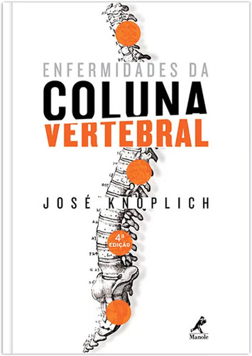 Enfermidades da coluna vertebral, de Knoplich, José. Editora Manole LTDA, capa mole em português, 2015