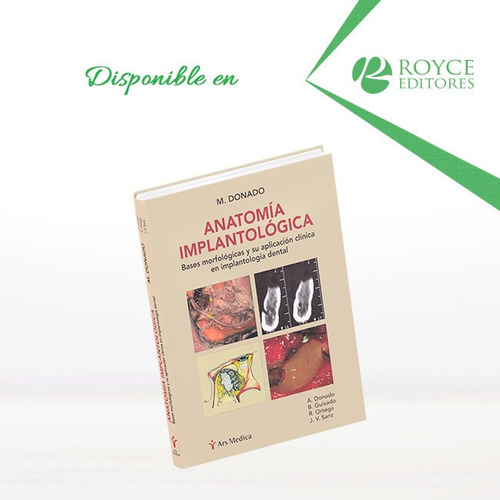 Anatomía Implantológica