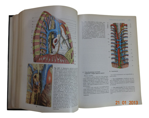 Anatomía Humana Latarjet 3ra Edición Volumen I Y Ii (Usado)