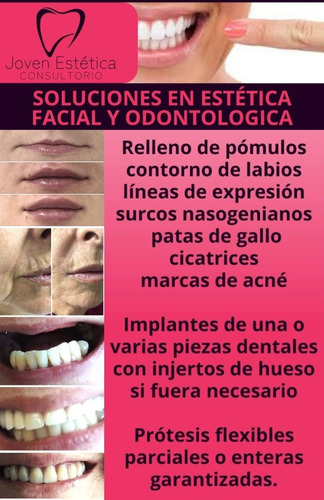 Imagen 4 de 4 de Implantes Dentales Protesis Estética Facial