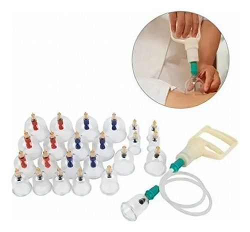 Kit 12 Ventosas Relajacion Adelgazamiento Terapeuticas