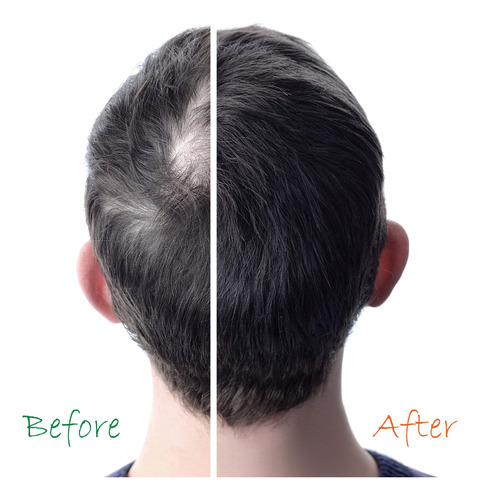 Set Energético Orgánico Para El Crecimiento Del Cabello Con