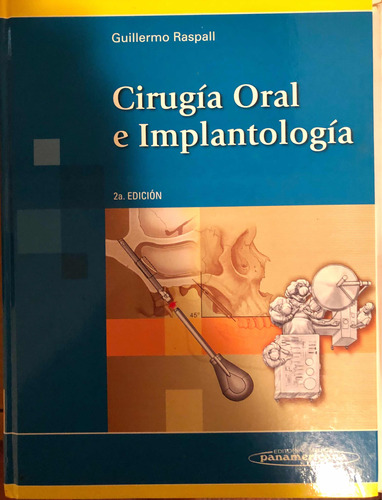 Cirugía Oral E Implantologia