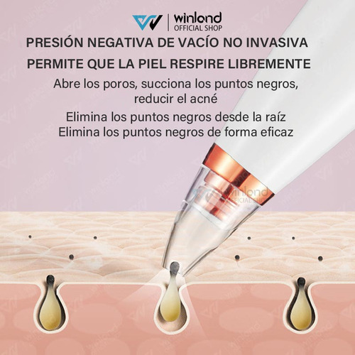 Removedor Espinillas,6 Sondas Succión Limpiadora Poros Acné