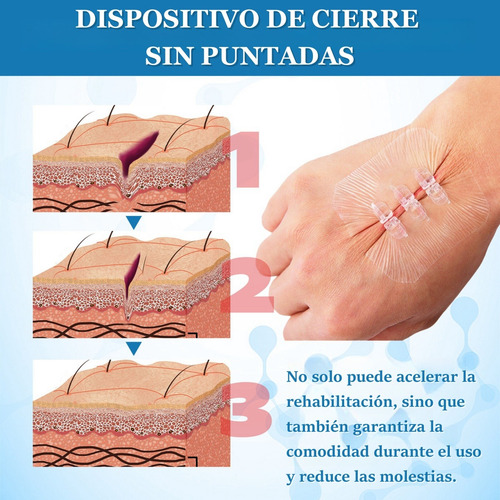 2 Tiras De Cierre Heridas De Emergencia Vendaje De Puntada