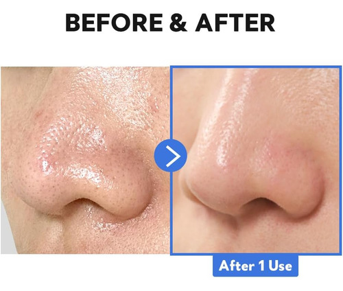 Bálsamo De Limpeza Enzimática Tirtir Hydro Boost, (0,30 Onça