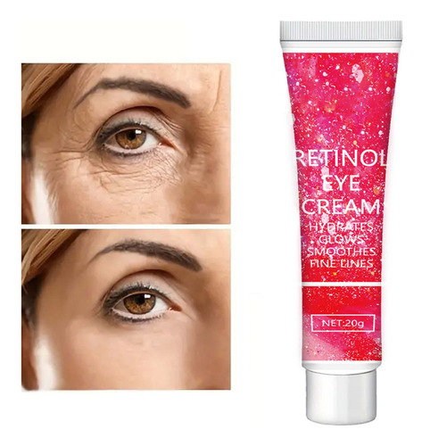 Creme Para Os Olhos J 20g Retinol - Hidratante E Redutor De