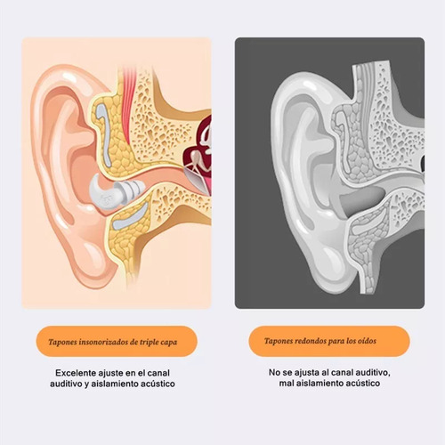 Tapones De Oído De Silicona Para Dormir Y Natación, 2 Pares
