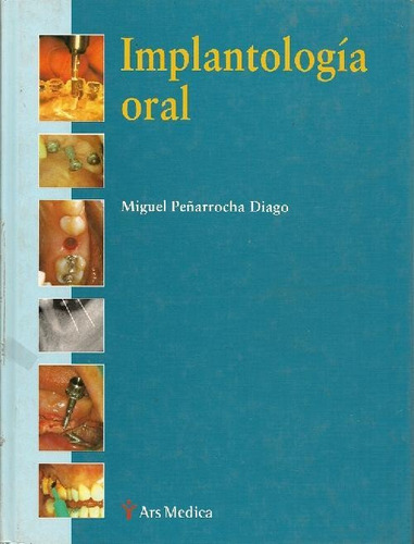 Libro Implantologia Oral De Miguel Peñarrocha Diago