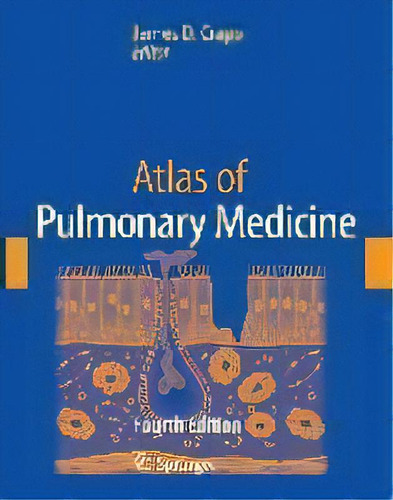 Atlas Of Pulmonary Medicine, De A. Jordan. Editorial Current Medicine,u.s., Tapa Dura En Inglés, 2008