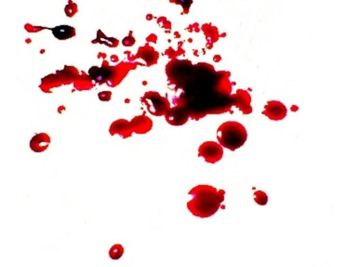 Imagem 5 de 7 de Sangue Líquido Cenográfico Falso Artístico 1 Litro