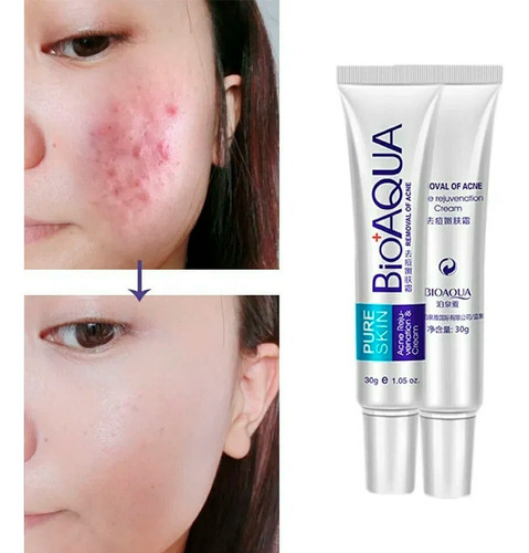 Imagen 6 de 9 de Crema Bioaqua Pureskin Elimina Acné Cicatrices Control Grasa