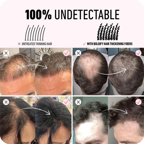 Hair Fibers Boldify, Rellena El Cabello Fino Y Fino, 28 G, N