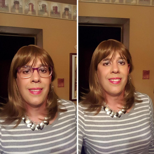 Gotas Para Los Ojos Secos Alivia Los Ojos Rojos Elimina La P