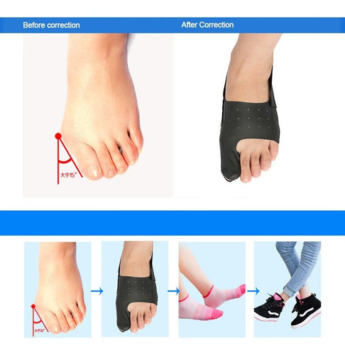 Corretor De Joanete Ultrafino Hallux Valgus