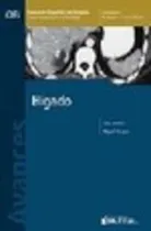 Comprar Libro Higado Avances En Diagnostico Por Imagenes Cir De Migu