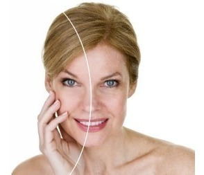 Serum Ac. Hialuronico E Retinol Clareador Manchas