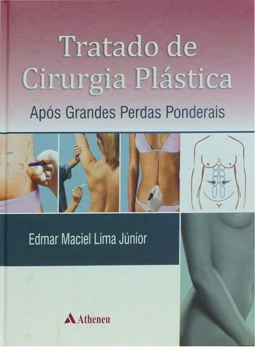 Tratado de cirurgia plástica após grandes perdas ponderais, de Lima Júnior, Edmar Maciel. Editora Atheneu Ltda, capa mole em português, 2010