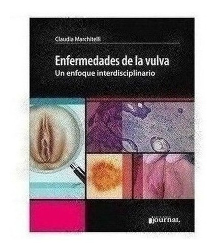 Enfermedades De La Vulva Un Enfoque Interdisciplinario - Ma