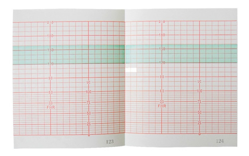 Papel Térmico Para Tococardiógrafo 112mm X 90mm - 10 Piezas