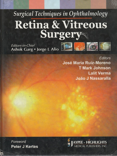 Retina & Vitreous Surgery Ashok Garg- Jorge L Alio