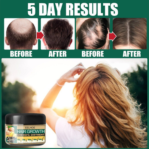 Xinnuo 120ml Aceite Jengibre Denso Crema Crecimiento Cabello