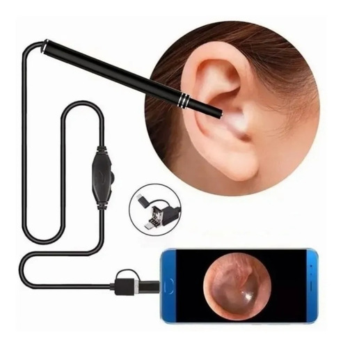 Imagen 1 de 10 de Otoscopio Digital, Cámara De Oídos Para Usar En Pc Y Celular