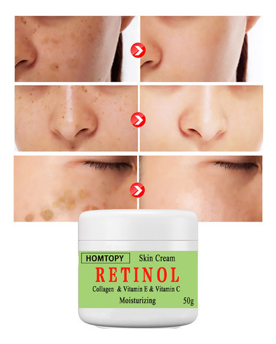 P Skin Beautifying Ilumina E Rejuvenesce A Pele Beaut 1014