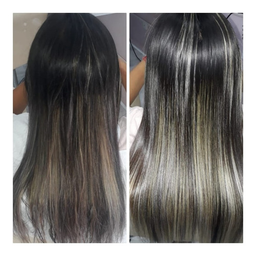 Cirugia Capilar Celulas Madres Litro K - L a $44000