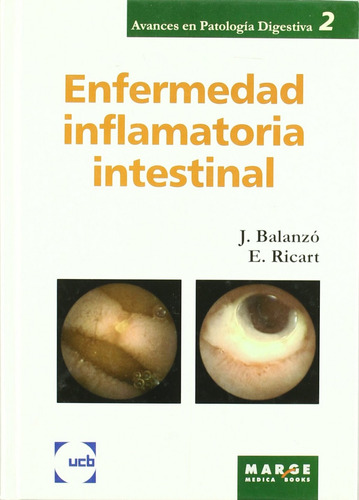 Enfermedad Inflamatoria Intestinal  - Aa.vv