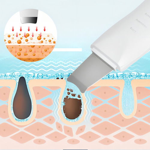 Espátula Facial Ultrasónica Usb Sonic Skin Scrubber