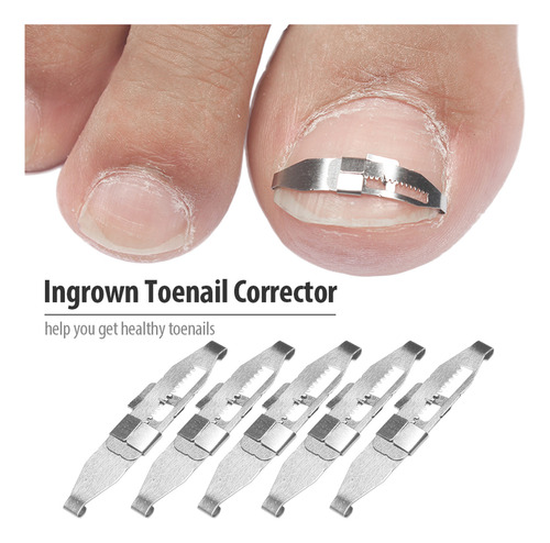 Corrector De Uñas Encarnado, Herramienta Para El Cuidado De