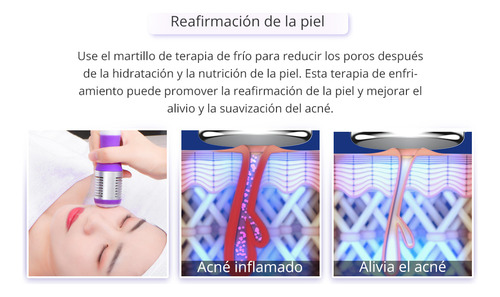 Equipo Multifuncional De Radiofrecuencia 9 Funcions En 1 Con Cavitación 2.0 Avanzada De 40k , Martillo, Vacum, Lipolaser. 8 Manerales Robustos