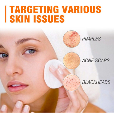 Creme Facial Salicílico - Hidratante E Corporal