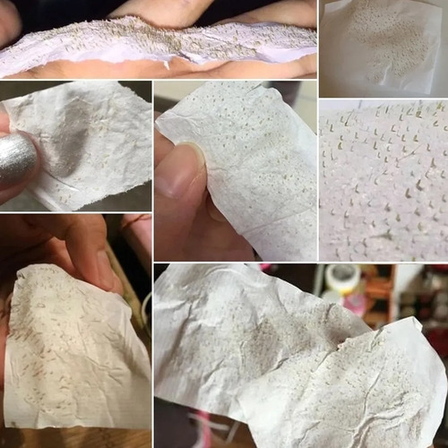 4x Máscara Removedor De Cravos Com Tiras De Limpeza De Poros