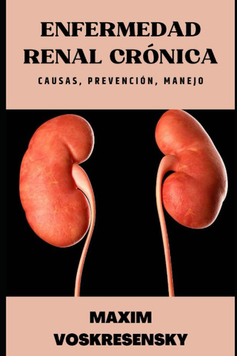 Libro: Enfermedad Renal Crónica; Causas, Prevención, Manejo 