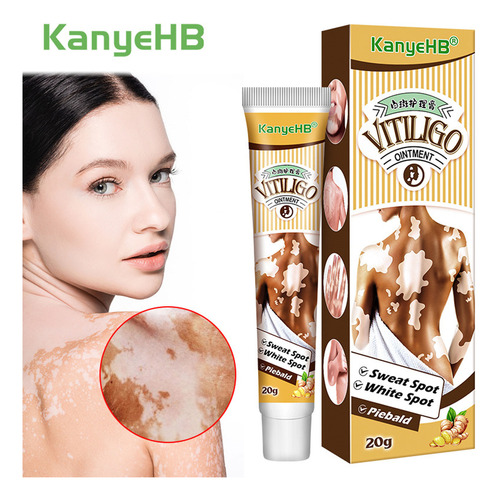 Crema Hidratante Para El Cuidado De La Piel Vitiligo Cream R