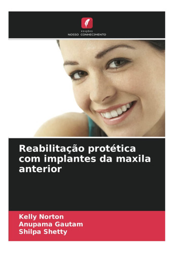 Libro: Reabilitação Protética Com Implantes Da Maxila
