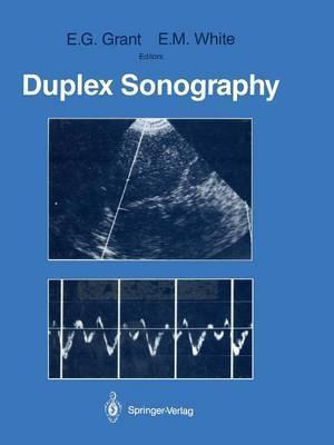 Libro Duplex Sonography - Edward G. Grant