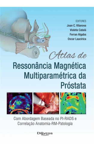 Atlas De Ressonancia Magnetica Multiparametrica Da Prostata, De Joana C. Vilanova. Editora Dilivros, Capa Dura Em Português, 2019