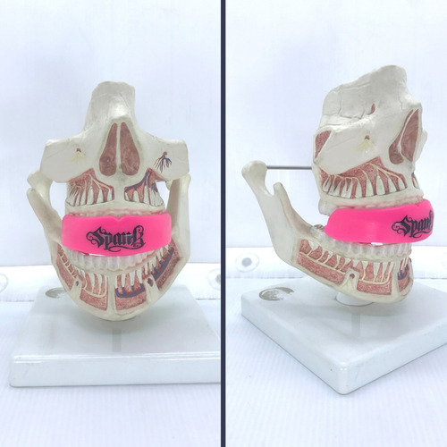 Protetor Bucal Profissional Com Estojo Arcada Superior Spank Cor Rosa Sabor Sem Sabor