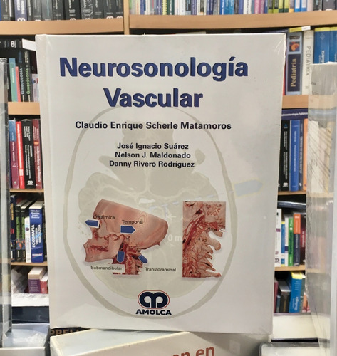 Neurosonología Vascular