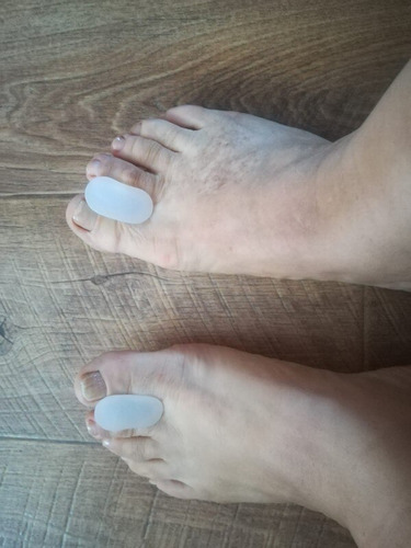 Separador De Dedos Do Pé Pedicure Alívio (1 Par)