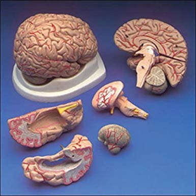 Presupuesto Del Cerebro Con Arterias Modelo