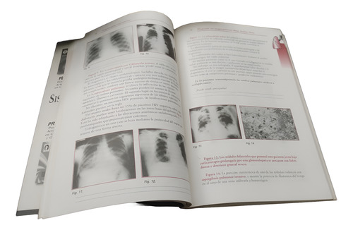 Proami - Medicina Interna Fernando Lasala Ed . Panamericana (Usado)